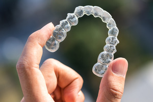 Picture of clear aligners